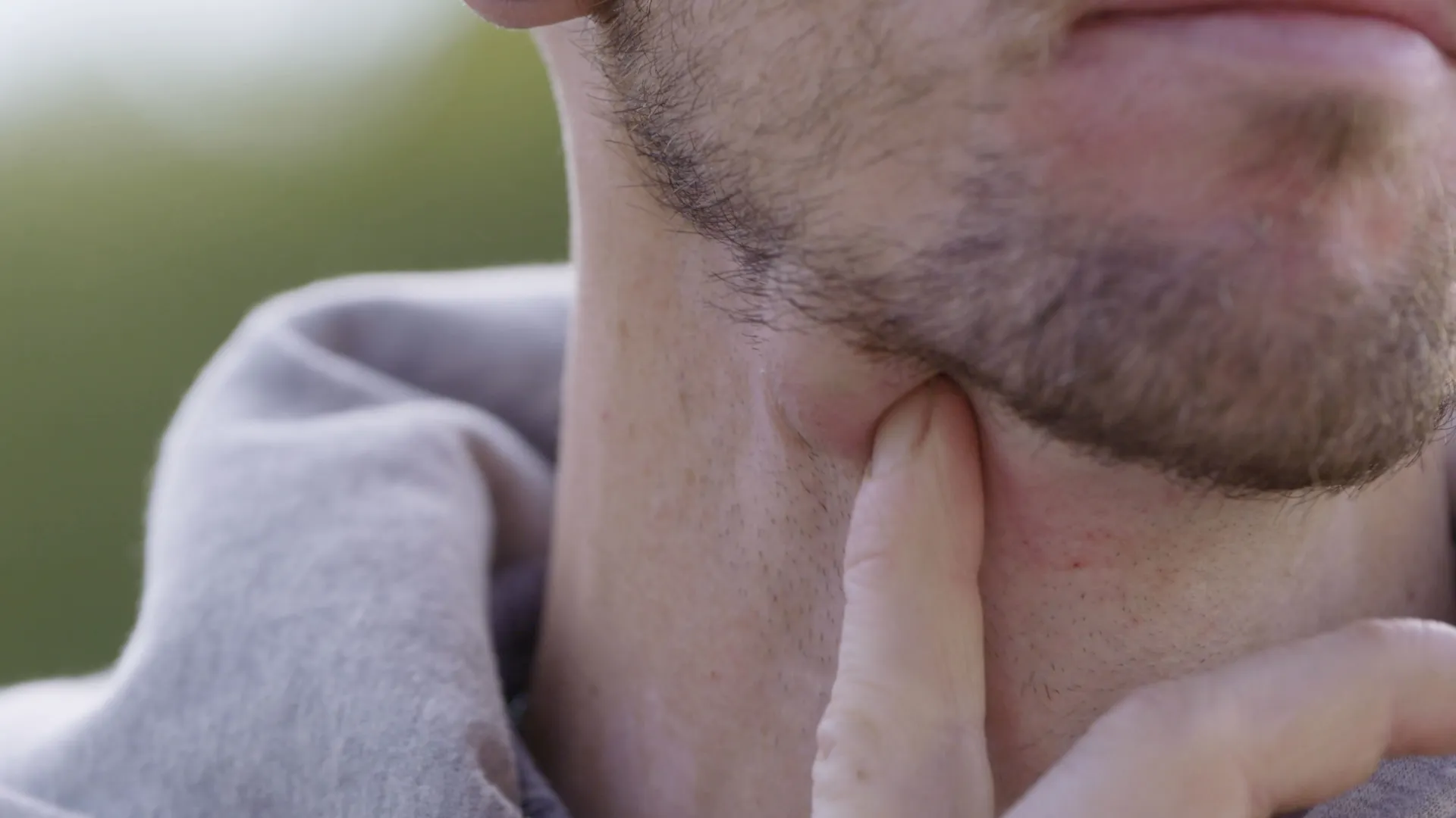 thumbnail - S1:E6 Jaw Dropper