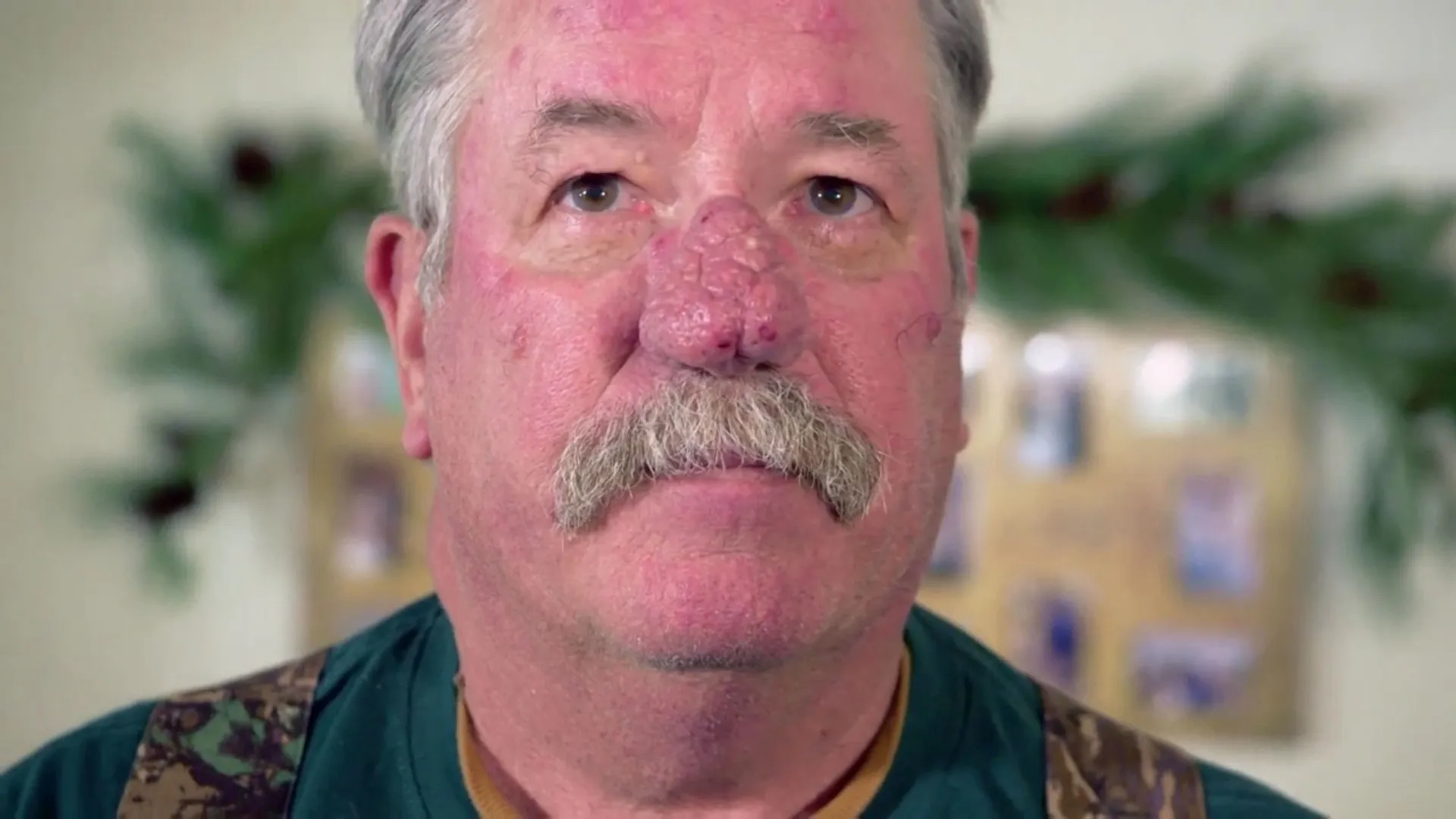 thumbnail - S2:E5 Every Rosacea Has Its Thorn