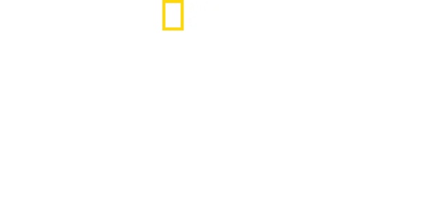 密着！ある少女の顔面移植手術