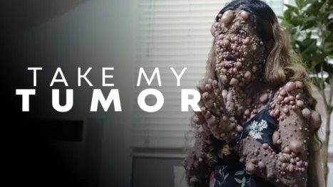 thumbnail - Take My Tumor