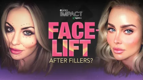 thumbnail - IMPACT x Nightline: Facelift: After Fillers?