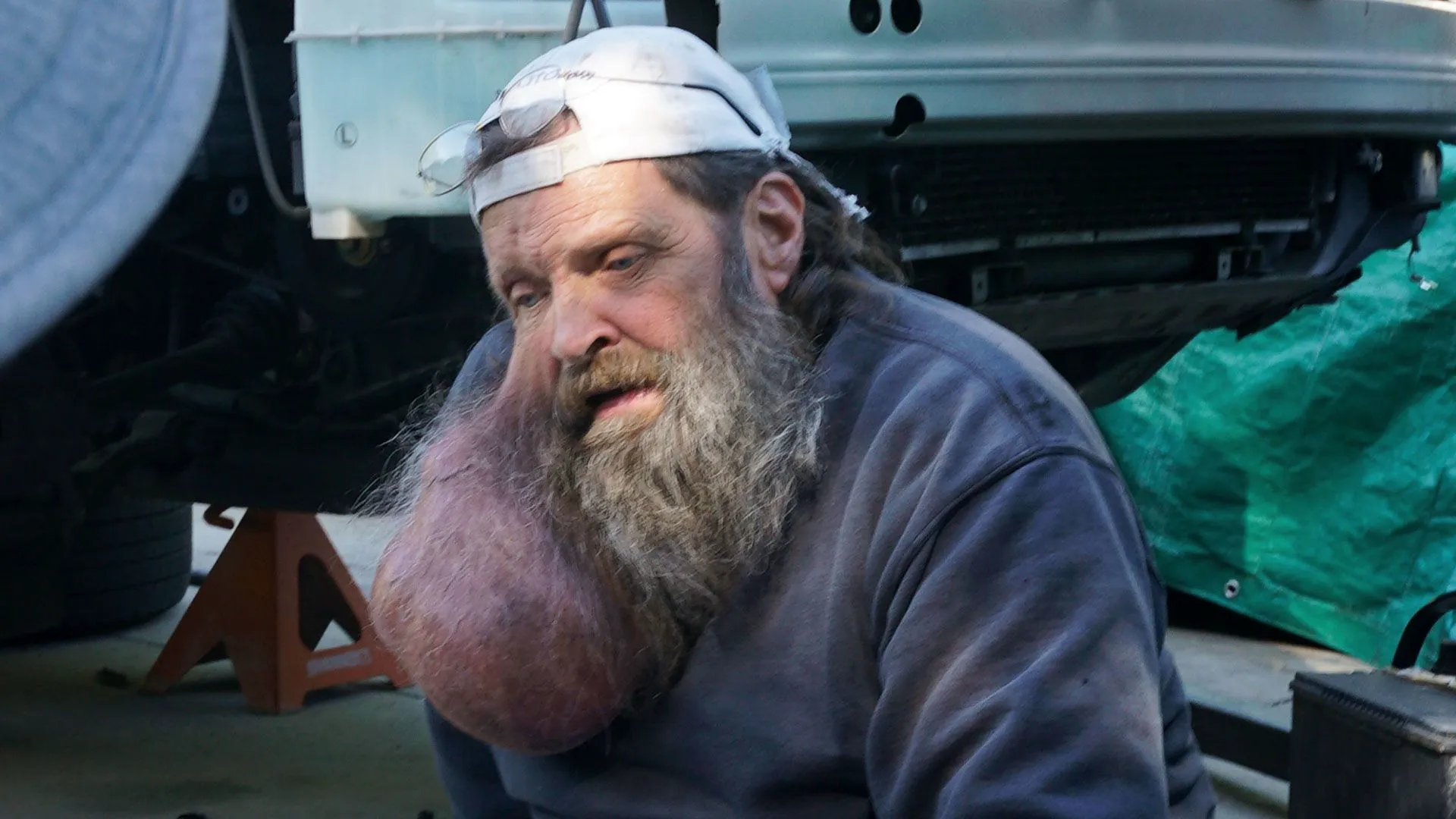 thumbnail - S1:E3 The Man With the Talking Neck Tumor