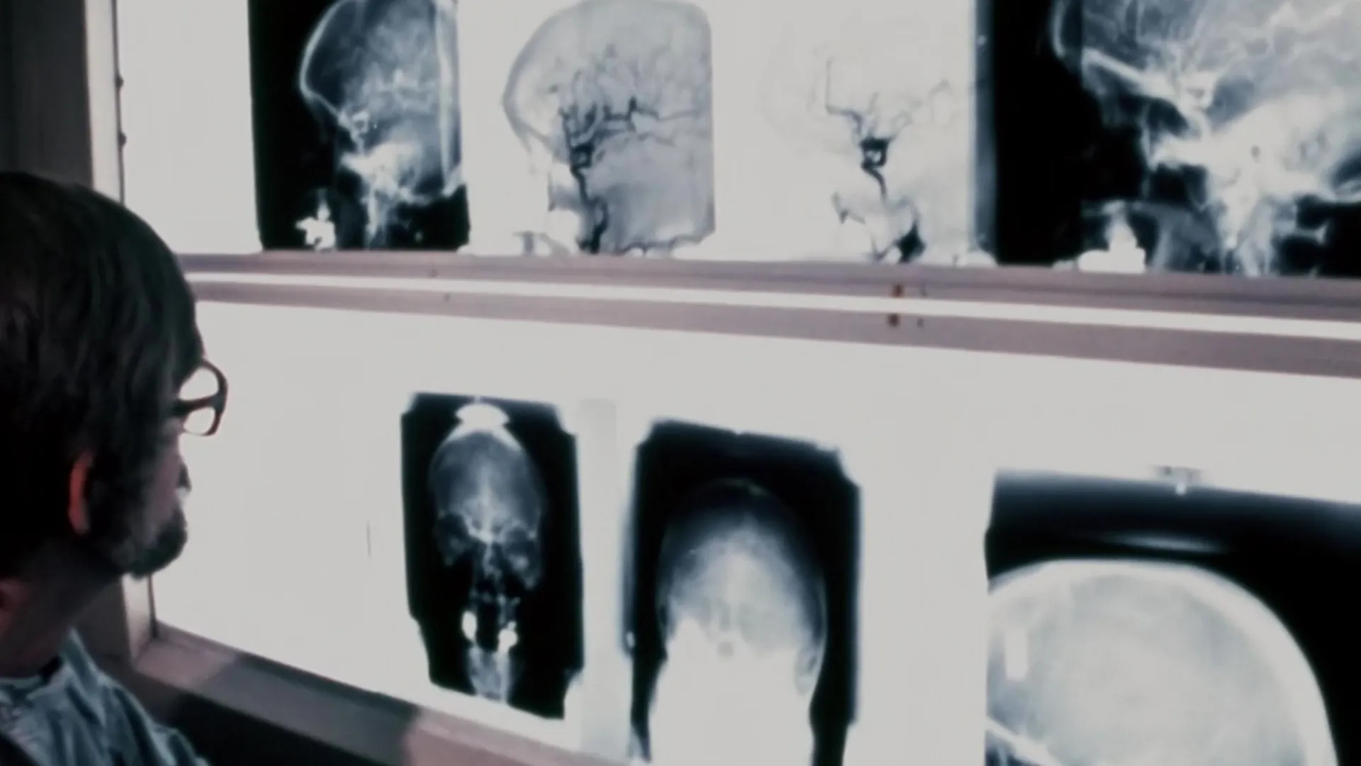 thumbnail - S1:E3 The Mind of a Killer