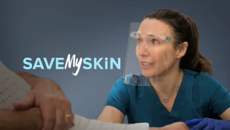 thumbnail - Save My Skin