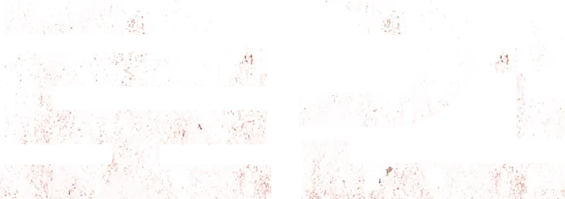 로건