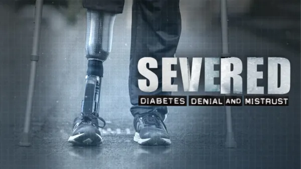 thumbnail - Severed: Diabetes Denial and Mistrust 