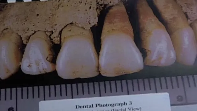 thumbnail - S7:E18 Stranger Than Fiction