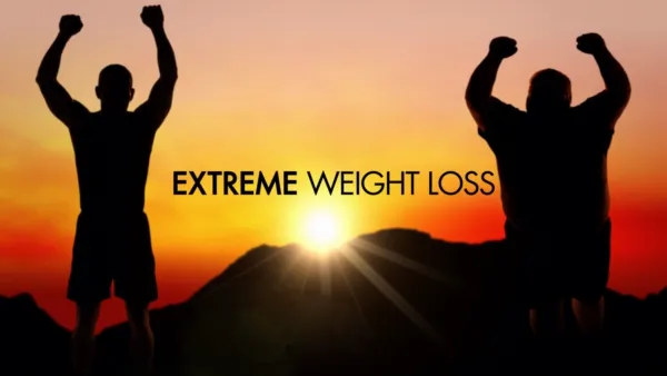 thumbnail - Extreme Weight Loss