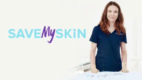 thumbnail - Save My Skin
