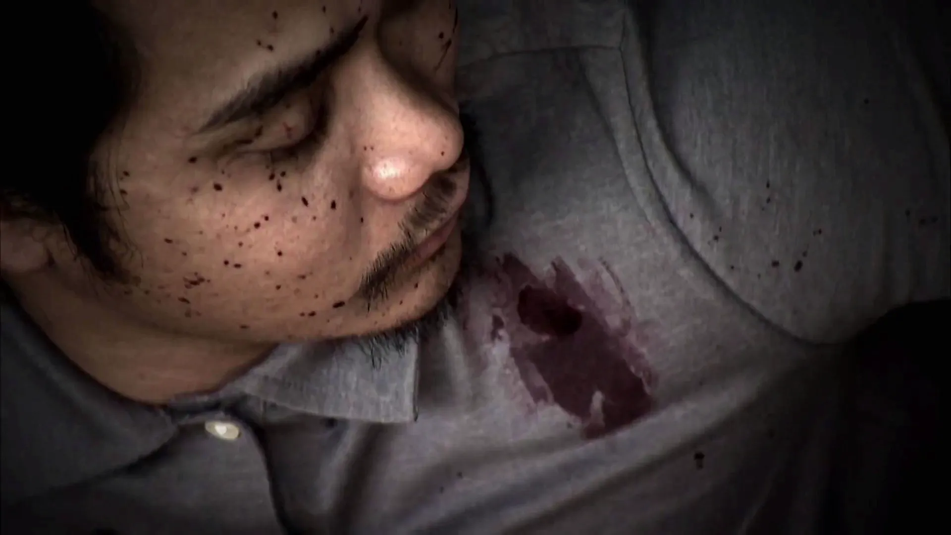 thumbnail - S3:E11 Got Shot In The Leg