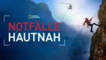 thumbnail - Notfälle hautnah