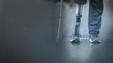 Severed: Diabetes Denial and Mistrust 