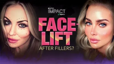 thumbnail - IMPACT x Nightline: Facelift: After Fillers?